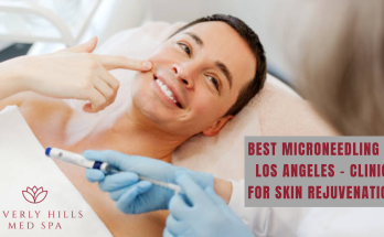 best microneedling in los angeles