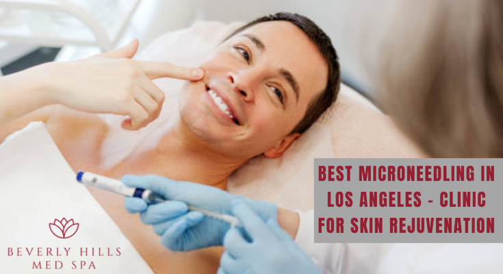 best microneedling in los angeles