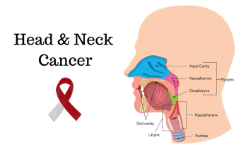 Head and Neck Cancer