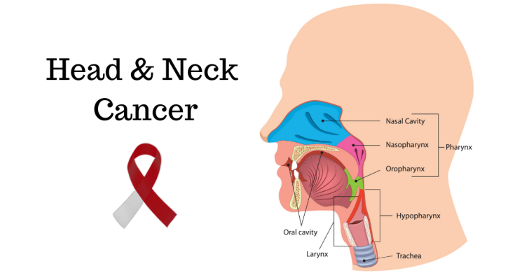 Head and Neck Cancer